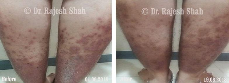 lifeforce homeopathy case-photos